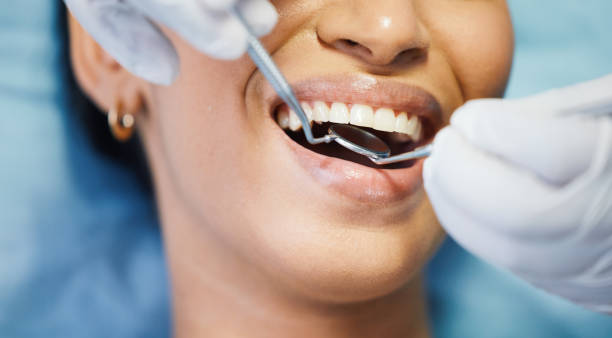 Best Broken or Chipped Tooth Repair in Albertville, MN