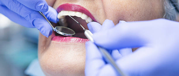 Best Broken or Chipped Tooth Repair in Albertville, MN
